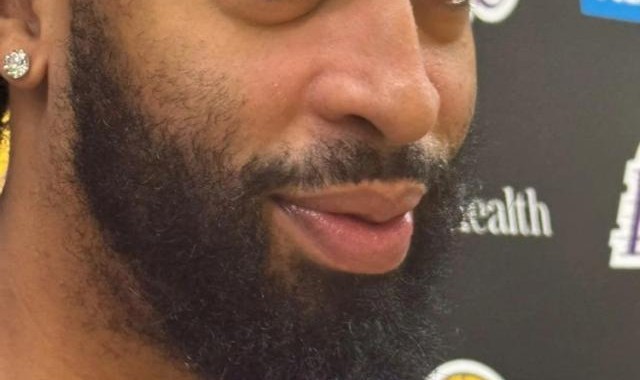 百家乐规则-湖人内线一喜一忧——戴维斯眼部无恙，伍德伤情反复